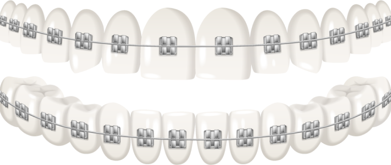 bracket